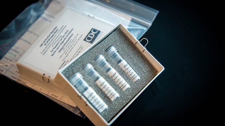 Center for Disease Control’s laboratory test kit for coronavirus.